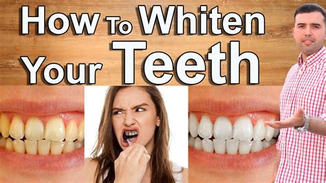 How To Whiten Teeth In Minutes 5 Home Remedies To Whiten Teeth
