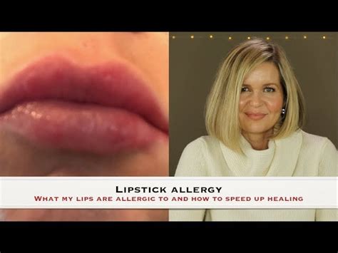 Why Are My Lips Allergic To Everything Lipstutorial Org
