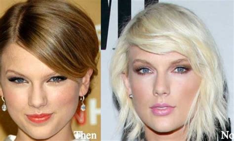 Taylor Swift Plastic Surgery Before And After Take Taylor Swift For