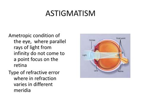 Ppt Astigmatism And Presbyopia Powerpoint Presentation Free Download