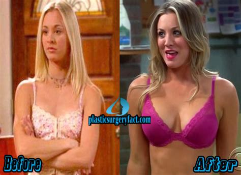 Kaley Cuoco Boob Job Before And After
