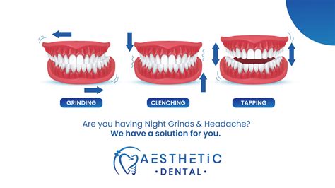 Dental Bruxism Teeth Grinding Causes Symptoms And Treatment