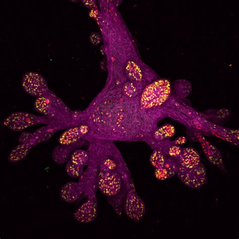 Lab Grown Human Mammary Gland Organoid Nikons Small World