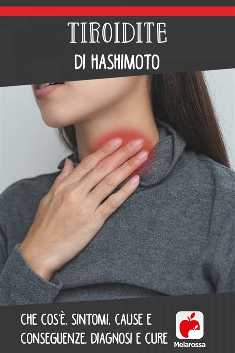 Tiroidite Di Hashimoto Che Cosè Sintomi Conseguenze Diagnosi E Cure