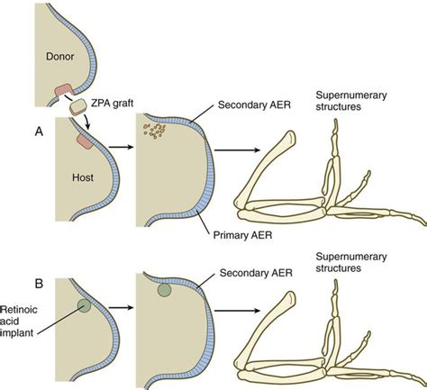 Limb Development Basicmedical Key