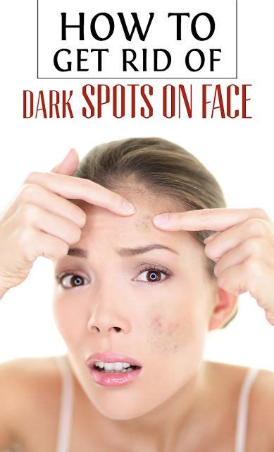 Dark Spots How To Get Rid Of Them Spots On Face Dark Spots On Face