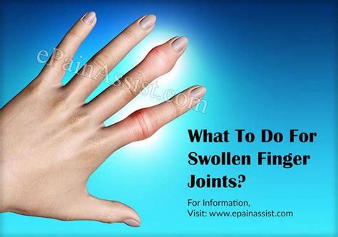 Swollen Knuckle Finger 15 Causes Of Swollen Fingers