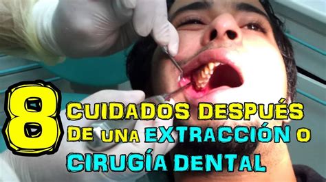 8 Cuidados DespuÉs De Una ExtracciÓn O CirugÍa Dental Dr Rod Youtube