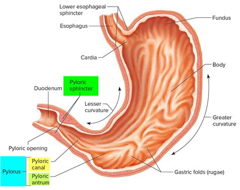 Pyloric Stenosis Causes Symptoms Complications Treatment