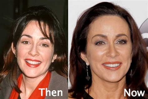Patricia Heaton Plastic Surgery Breaststits And Boobs