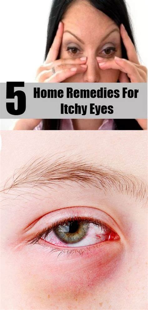 5 Home Remedies For Itchy Eyes