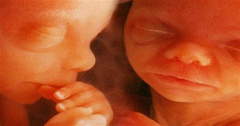 Twins In The Womb A Parable About The Importance Of Being Open Minded