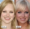 Anna Faris before and after nose job surgery