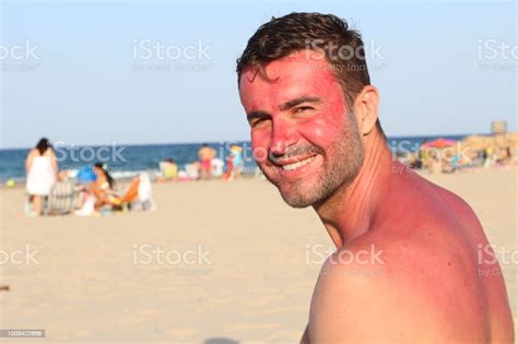 Man Smiling While Getting Sunburned Stock Photo Download Image Now