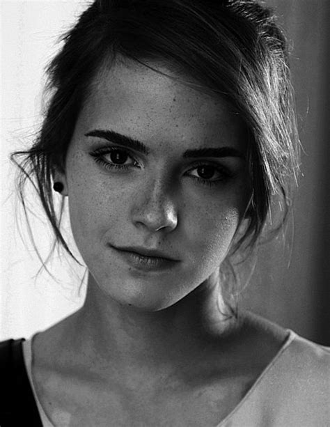 Emma Watson Hermione And Freckles On Pinterest