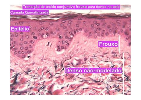 Tecidos Epitelial E Conjuntivo Histologia E Embriologia Sexiz Pix
