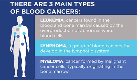It is our third biggest cancer killer, and yet misunderstandings about the signs and symptoms of this cancer exist. Blood Cancer Clinical Trials | Study Connect