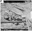Civil War Photos - Casualties