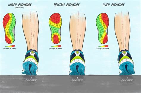 Types Of Pronation Determine Your Type Here Pronation Defines The