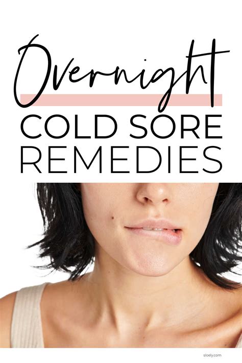 Natural Remedies For Cold Sores