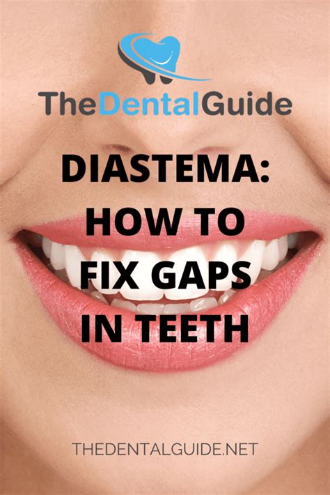 There are several treatments available for gappy teeth and fixing them carries both aesthetic and. Diastema: How To Fix Gaps In Teeth - The Dental Guide USA