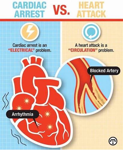 Arrest Cardiac Attack Difference Between Heart