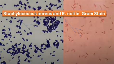 Staphylococcus Aureus And E Coli In Gram Stain GPC In Singles Pairs