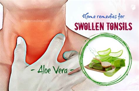 84 Home Remedies For Swollen Tonsils Pain With White Patches
