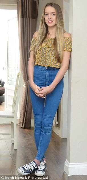 Teen Girl Stands Tall For First Time In 10 Years After Scoliosis