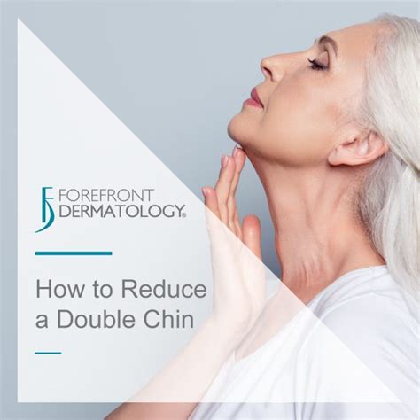 How To Get Rid Of A Double Chin Without Surgery Forefront Dermatology
