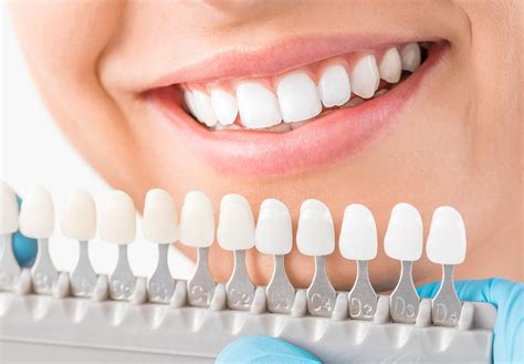 Cosmetic Teeth 5 Reasons To Get Veneers Estilo Tendances