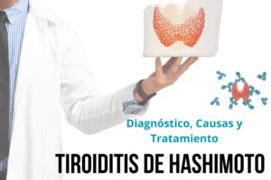 Tiroiditis De Hashimoto Causas Diagn Stico Y Tratamiento