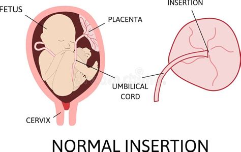 Embarazo Normal Anatom A Femenina Anatom A Infograf A De Vectores