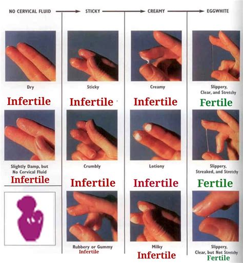 Yellow discharge could be a sign of infection. Early yellow cervical mucus discharge in pregnant women