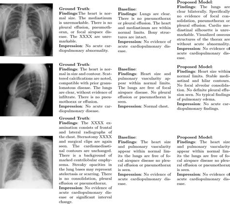 Qualitative Examples Of Generating Normal Findings And Impression