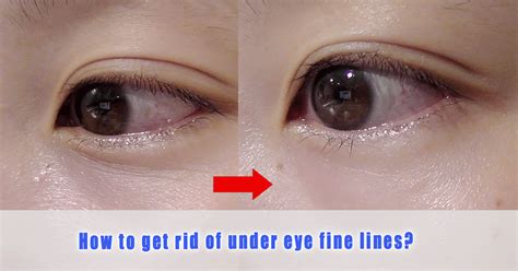 How To Get Rid Of Under Eye Fine Lines The Sesame Shop