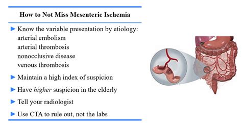 emergency medicine educationimproving the ed diagnosis of mesenteric ischemia