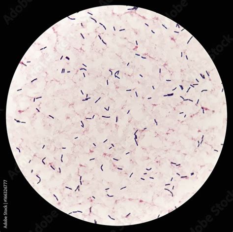 Smear Of Human Blood Culture Grams Stained With Gram Positive Bacilli