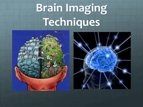 4 Types Of Brain Imaging Techniques