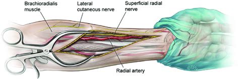 The Left Forearm Showing The Radial Artery Ulnar Artery The