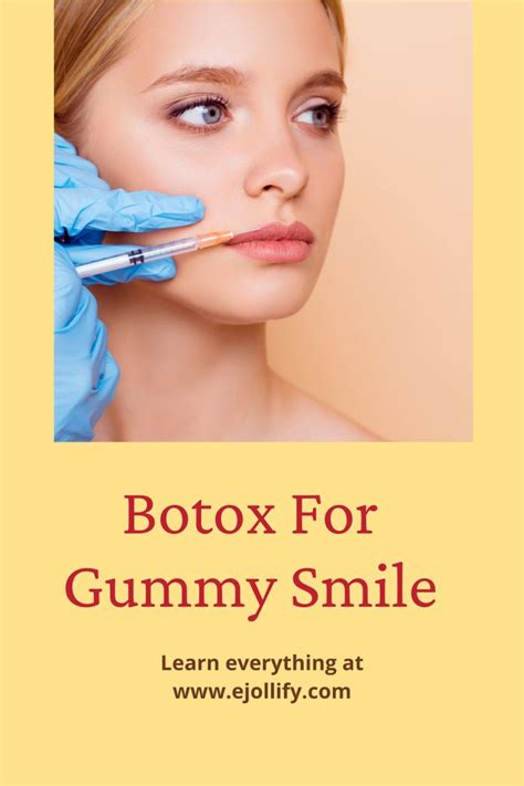 Botox For Gummy Smile The Complete Guide Gummy Smile Botox Botox Cost