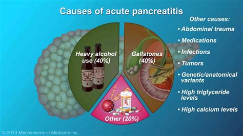 Acute Pancreatitis Youtube