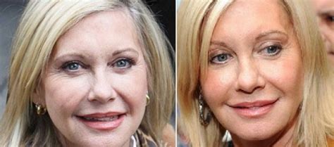 Singer Archives Page 3 Of 10 2016 Plastic Surgery Before And After