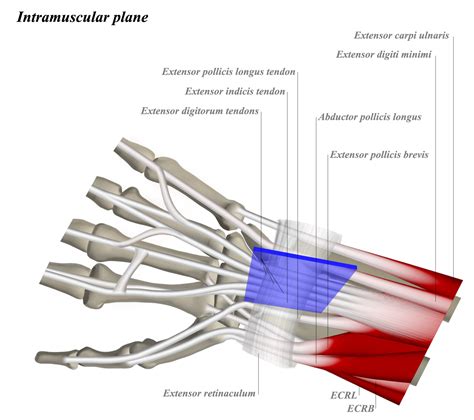 Dorsal Approach To The Wrist Approaches Orthobullets
