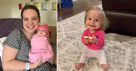 Two Year Old Girl With Rare Form Of Dwarfism Wears Newborn Sized