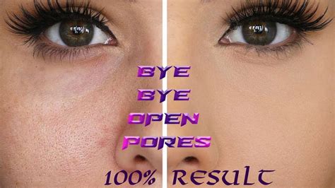 How To Shrink Large Open Pores Shrink Open Pores Permanently 100