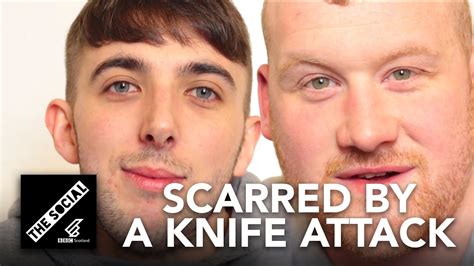 Scarred By A Knife Attack Youtube
