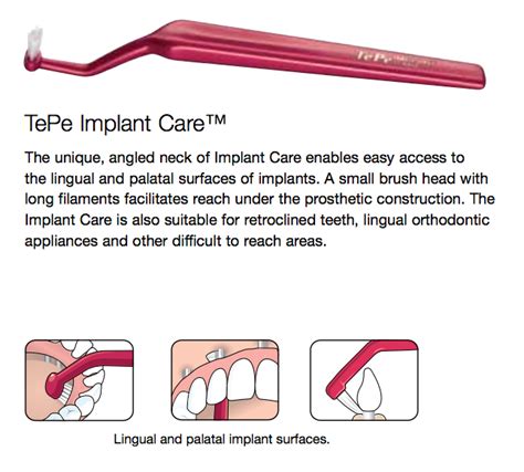 It has only been one day in the ezibox and my item is already missing. Tepe Implant Care | Toothgood