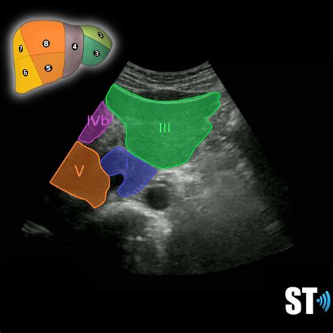 Couinauds Liver Segments Sonographic Tendencies Segmentation