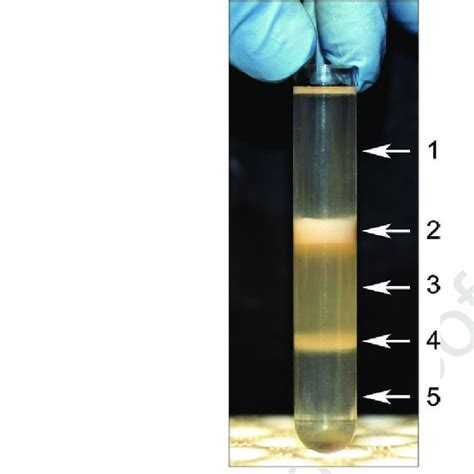 A Centrifuge Tube With Discontinuous Percoll Gradient And Synaptosomal